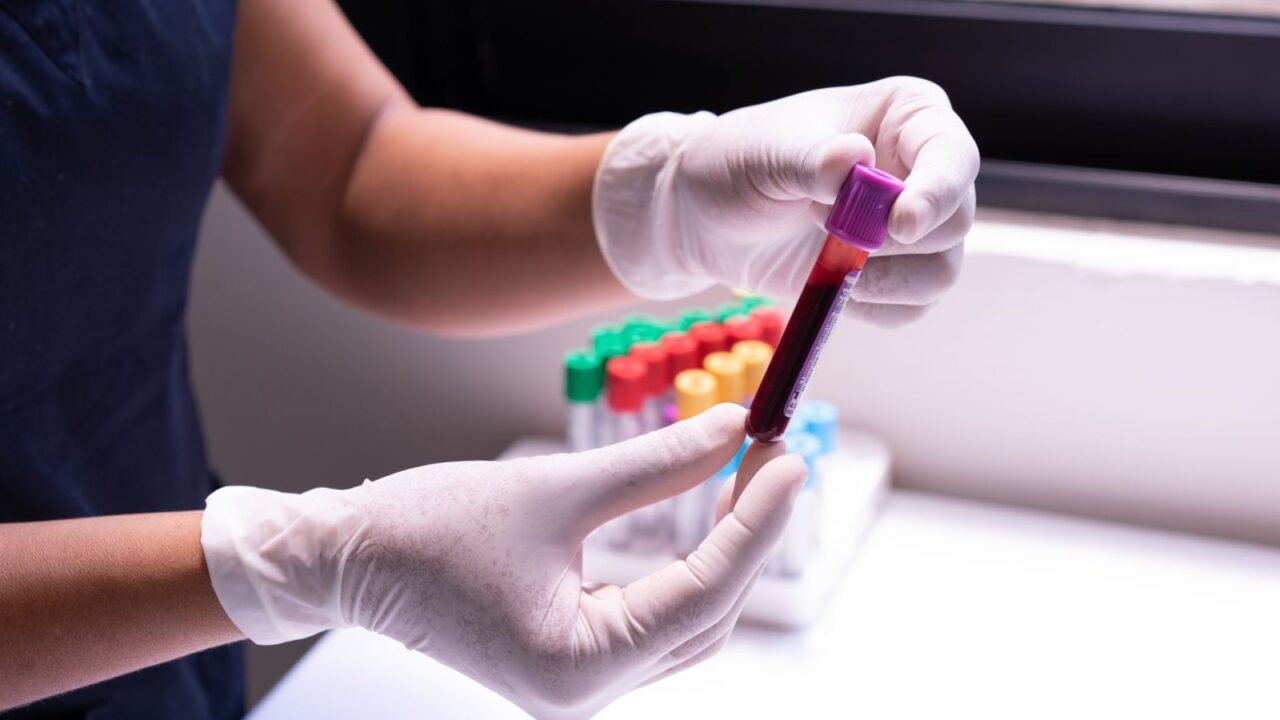 Alkaline Phosphatase (ALP) Test: Liver and Bone Health Marker