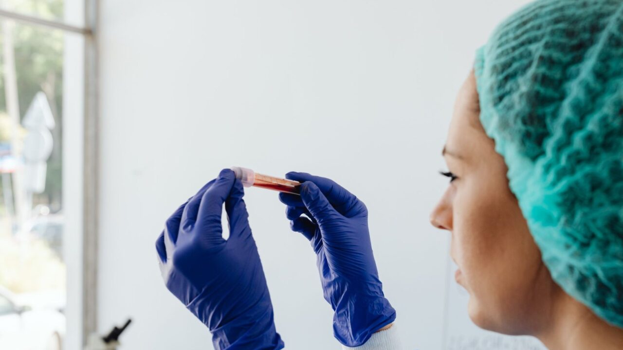 At-Home STD Tests: How They Work and Which to Trust