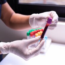GI Cancer Care Moves Toward Biomarker-Based Strategies, ASCO 2026 Report Highlights