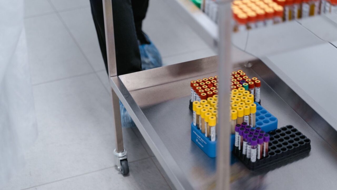 Cystatin C Test: A More Accurate Way to Measure Kidney Function