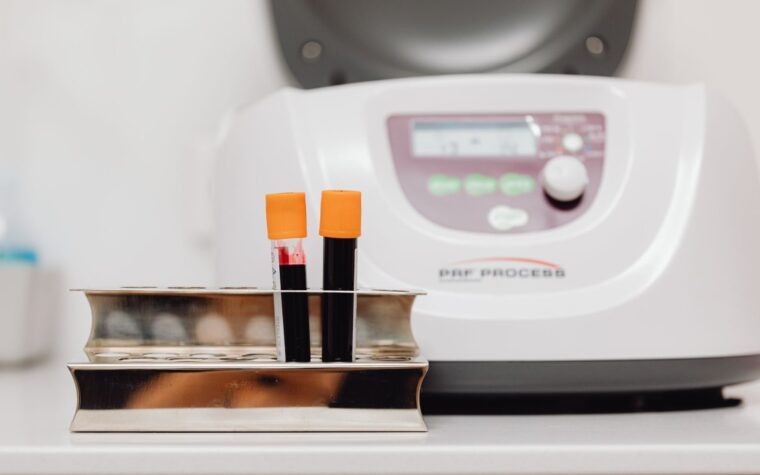 eGFR and Creatinine Explained: What Your Kidney Numbers Really Mean