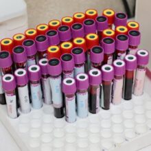 Full-Body Blood Test: What a Complete Health Panel Includes
