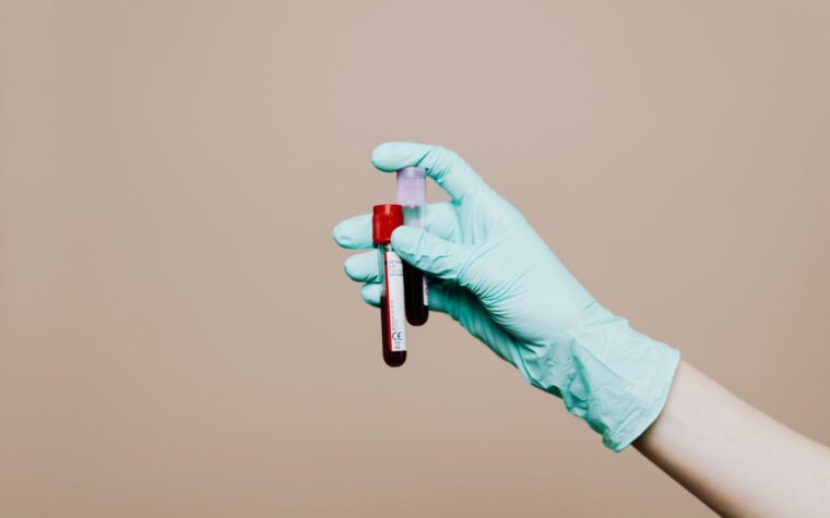 Homocysteine Levels Meaning: What High and Normal Numbers Tell You