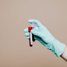 Is Function Health Worth It in 2026? An Honest Cost Breakdown