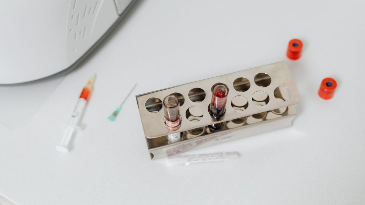 Injectable Hydrogel With Lacosamide Shows Promise for Osteoarthritis Pain and Cartilage Repair
