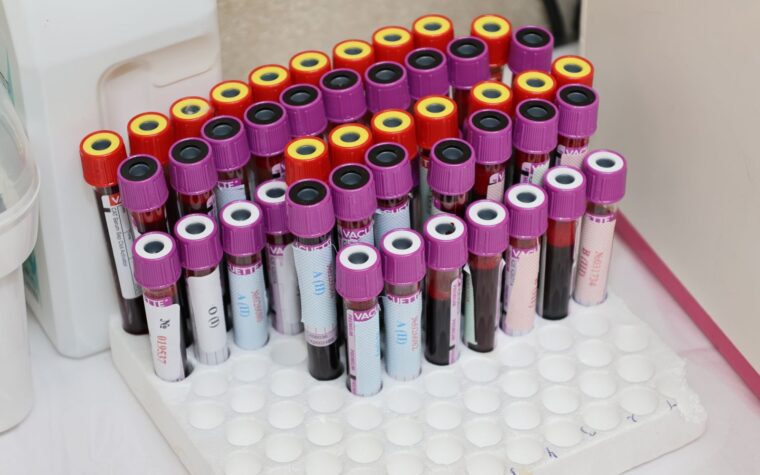 Potassium Blood Test: The Electrolyte That Steadies Your Heart