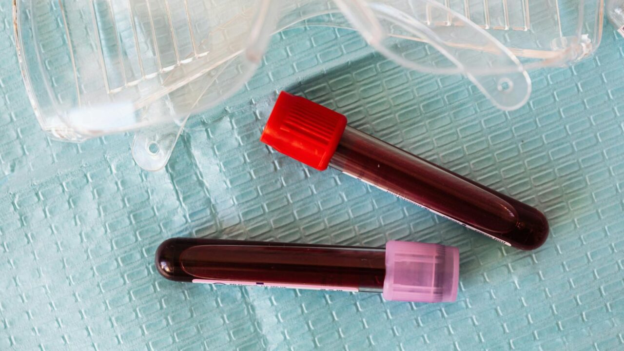 RBC Magnesium Test: What It Measures and Why It Beats a Standard Blood Test