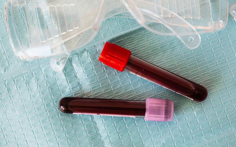 RBC Magnesium Test: What It Measures and Why It Beats a Standard Blood Test