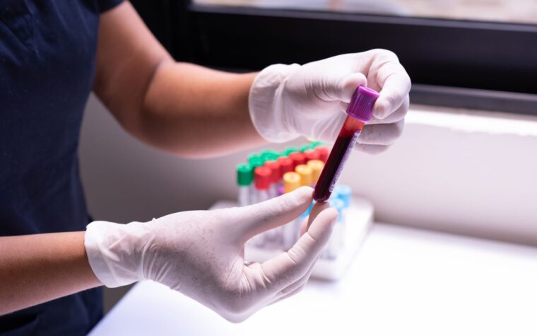Vitamin B6 Test: The Marker Behind Nerve and Mood Health