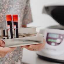 What Causes High Uric Acid Levels in a Blood Test?
