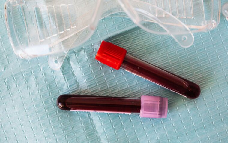 What Does Low Estradiol Mean in a Blood Test?