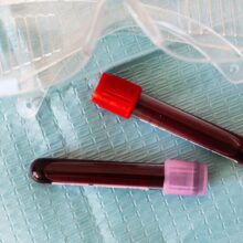 What Does Low LDL Cholesterol Mean in a Blood Test?