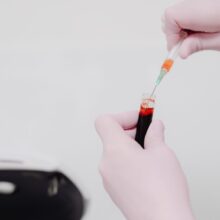 What Is Low Neutrophils in a Blood Test? What a Low Count Really Means