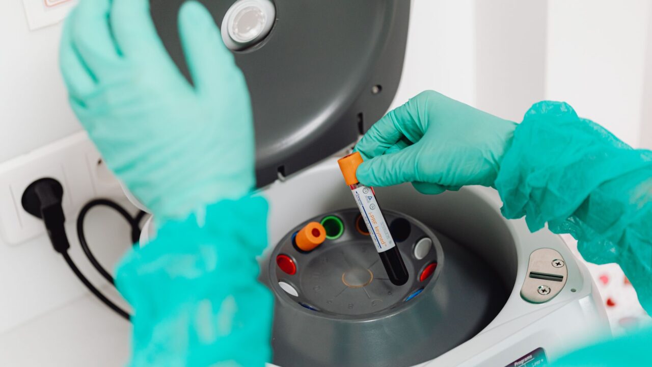 15 Biomarkers Everyone Over 40 Should Test (and What’s Normal)