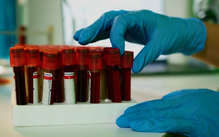 Annual Blood Work: The Tests Worth Getting Every Year