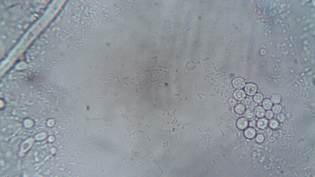 Best At-Home Iron and Ferritin Tests of 2026: 4 Compared