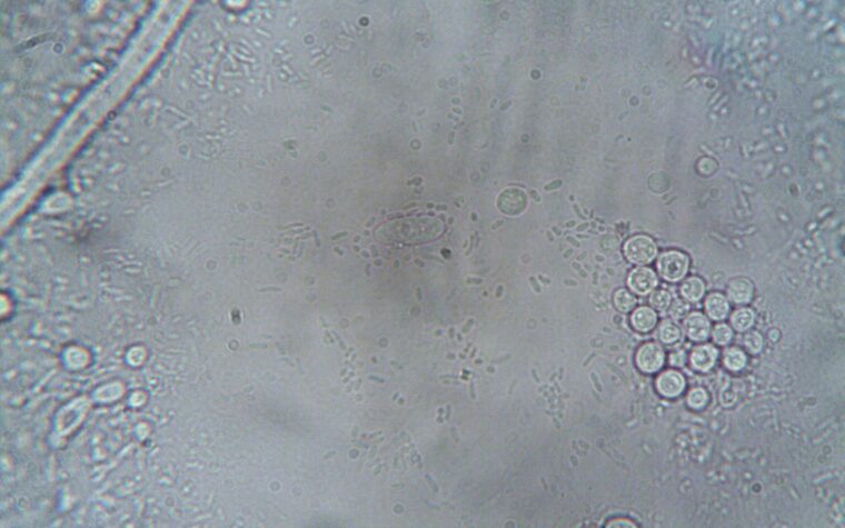 Best At-Home Iron and Ferritin Tests of 2026: 4 Compared