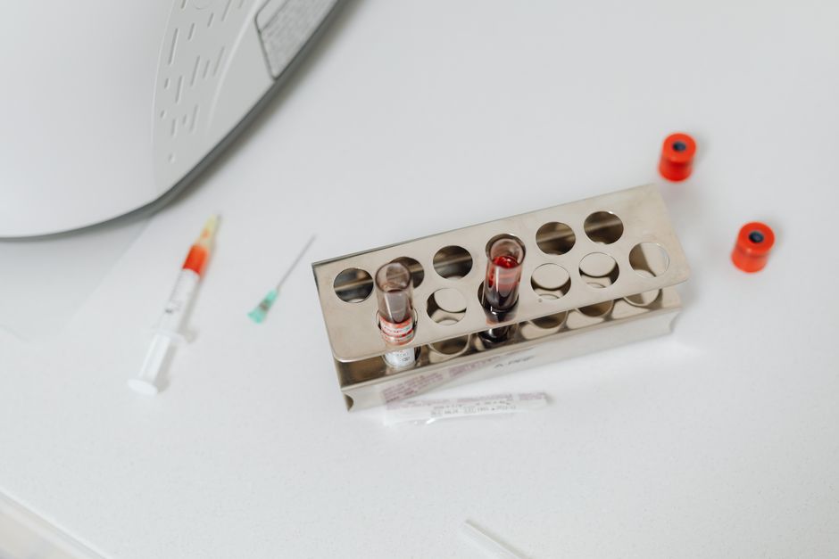 What Is WBC in a Blood Test? Your White Blood Cell Count, Decoded - blood analysis lab