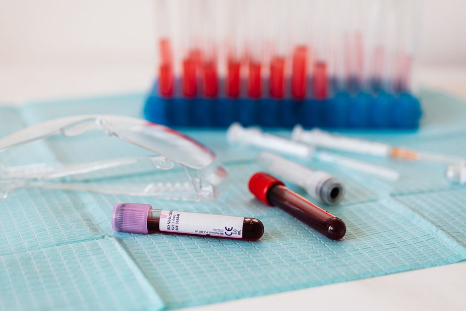 What Is NRBC in a Blood Test? The CBC Number That Should Read Zero - blood sample vial