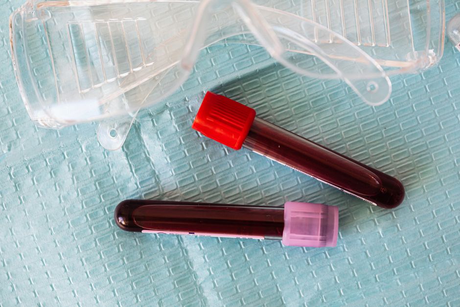 What Does High Eosinophils Mean in a Blood Test? Causes, Cutoffs, and  - blood sample vial