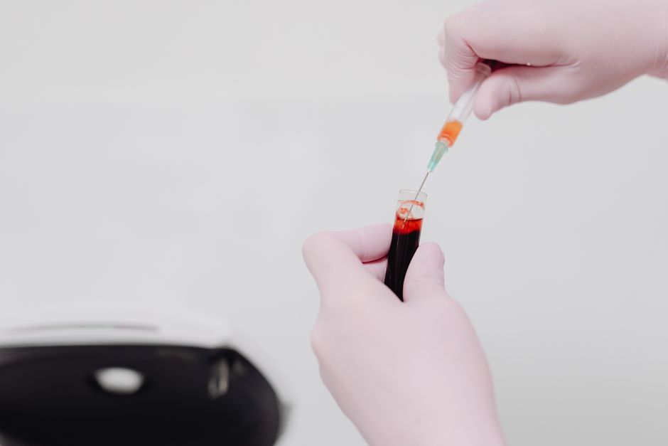 How to Read Vitamin D Blood Test Results: Decode Your 25(OH)D Number i - blood sample vial