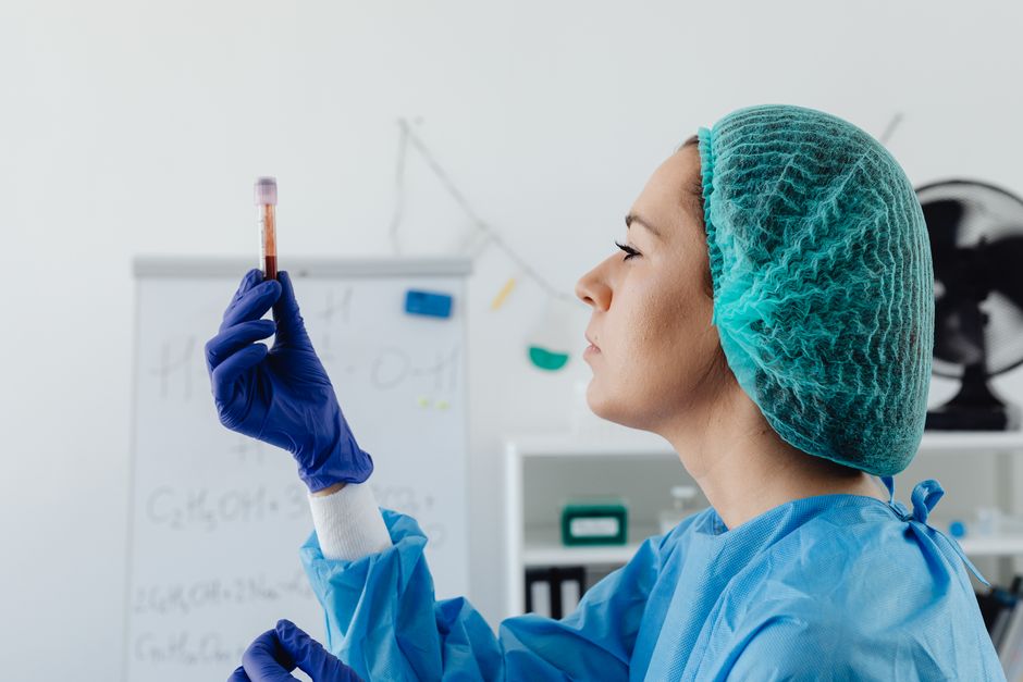 What Does Low Globulin Mean in a Blood Test? Causes & Next Steps - blood sample vial