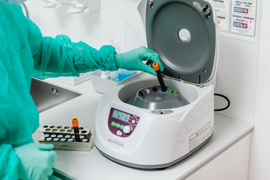 What Is RDW in a Blood Test? The Underrated Number That Predicts More - blood test laboratory