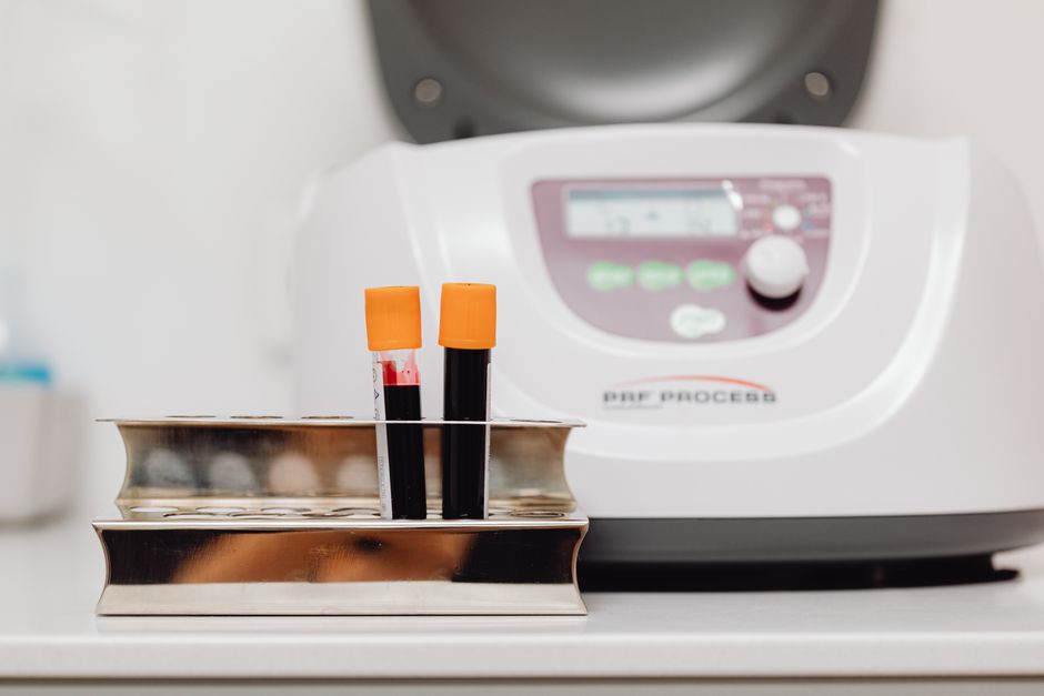 What Does Low Sodium Mean in a Blood Test? Why It Is Usually a Water P - blood test laboratory
