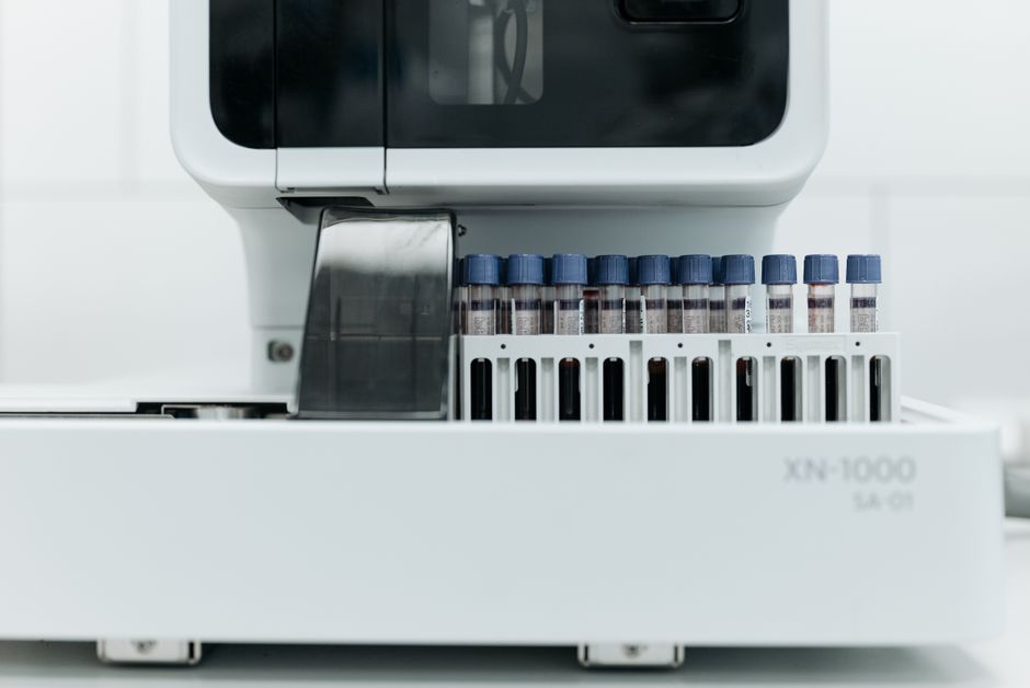 What Is Low Neutrophils in a Blood Test? What a Low Count Really Means - blood test laboratory