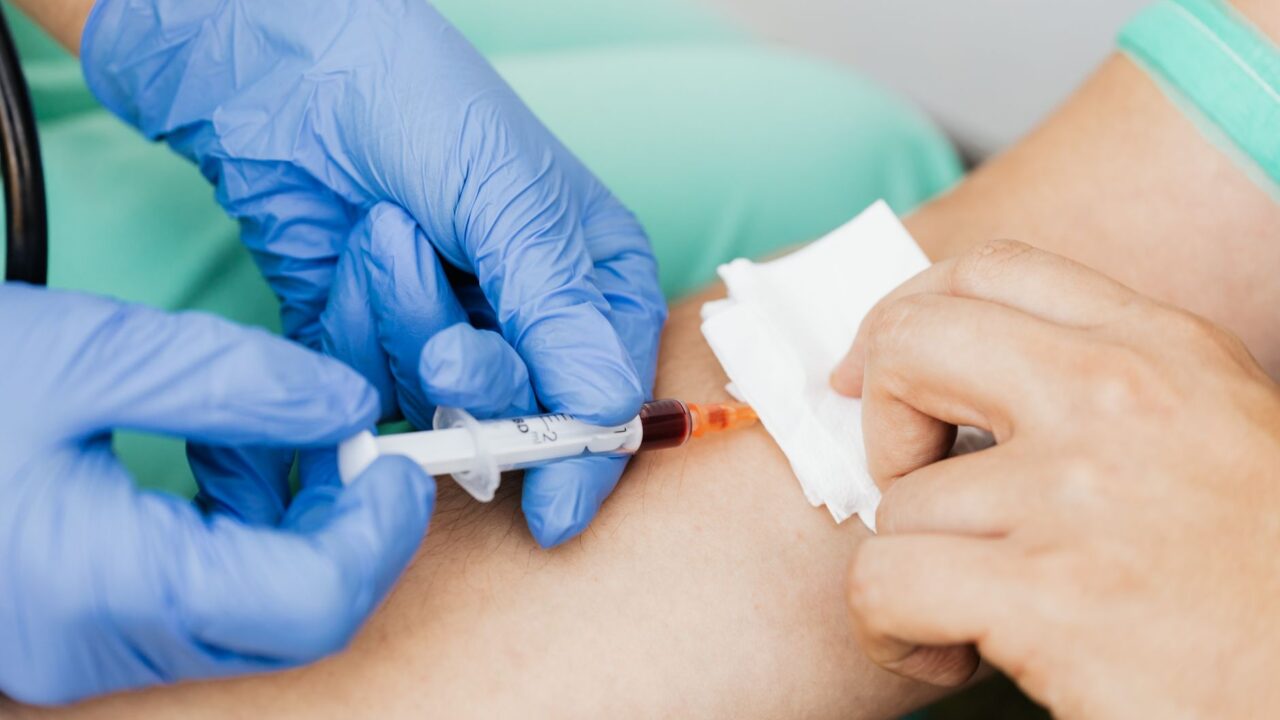 Blood Test Tube Colors and Their Meaning: A Clinician’s Guide