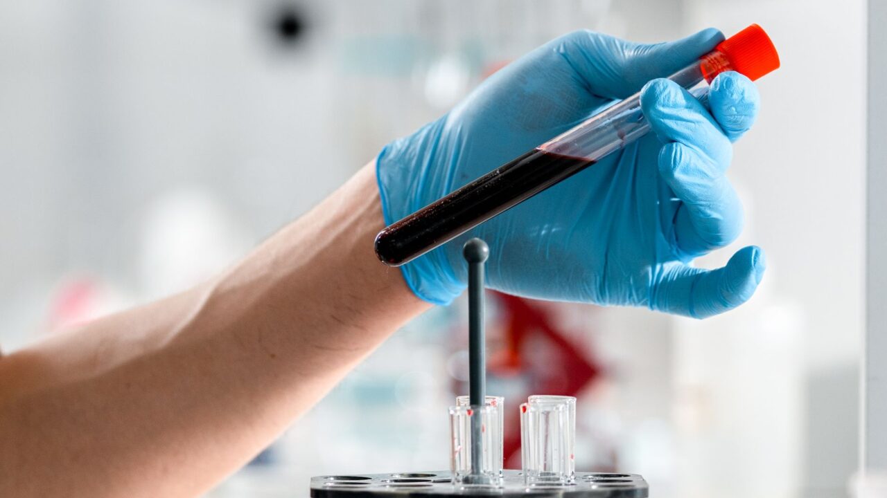 Complete Blood Count (CBC) Explained: Your Full Panel Guide