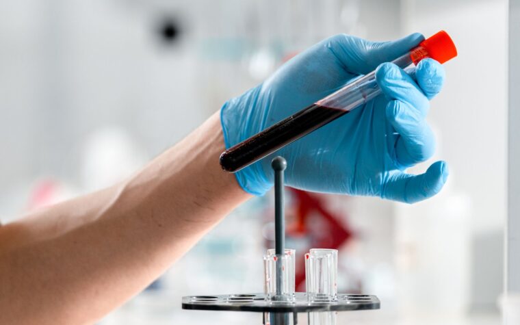 Complete Blood Count (CBC) Explained: Your Full Panel Guide