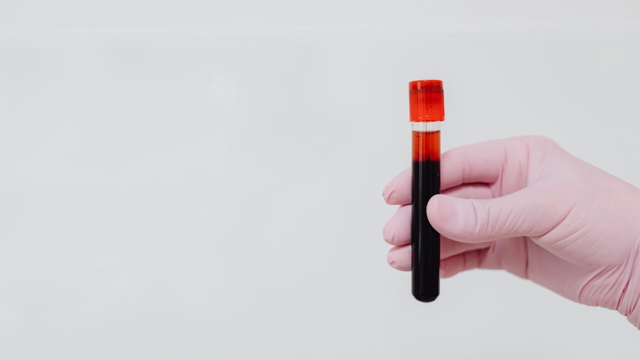 Complete Blood Count (CBC): What It Tests and What Results Mean