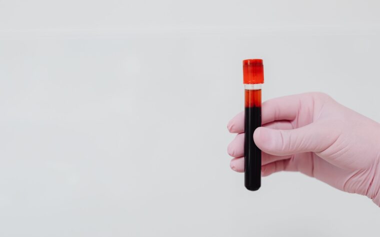 Complete Blood Count (CBC): What It Tests and What Results Mean