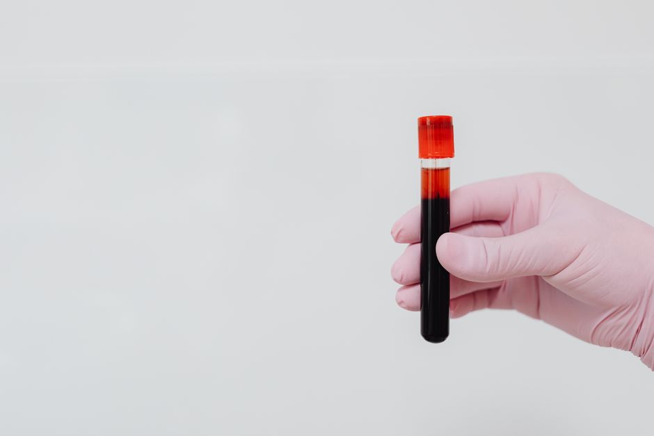 What Is a CBC Blood Test? A Plain-English Guide to the Most Common Lab - complete blood count lab