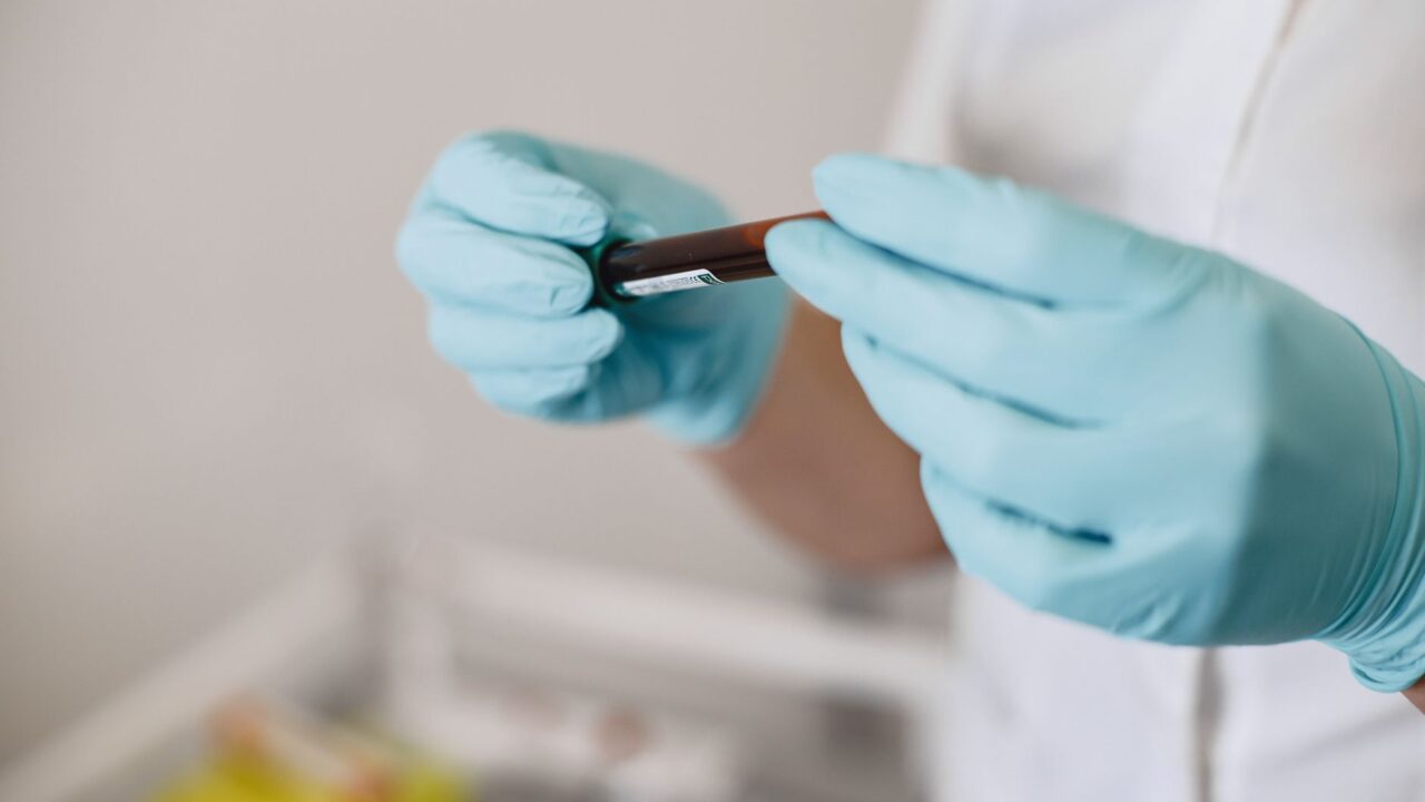Comprehensive Lab Tests Explained: What’s Actually Inside