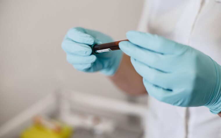Comprehensive Lab Tests Explained: What’s Actually Inside