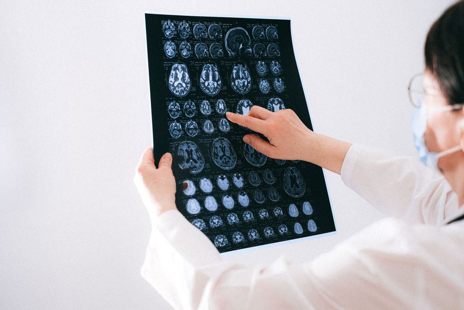 What Does a High BUN Mean in a Blood Test? Causes and Next Steps - doctor reviewing scan