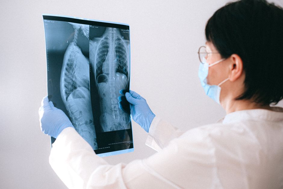 What Is a Low BUN on a Blood Test? Causes and When to Worry - doctor reviewing scan