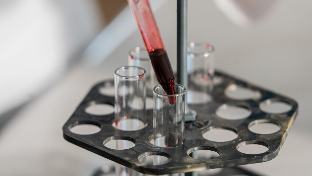 Does It Hurt to Get a Blood Test? What a Needle Really Feels Like