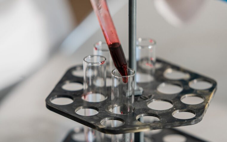 Does It Hurt to Get a Blood Test? What a Needle Really Feels Like