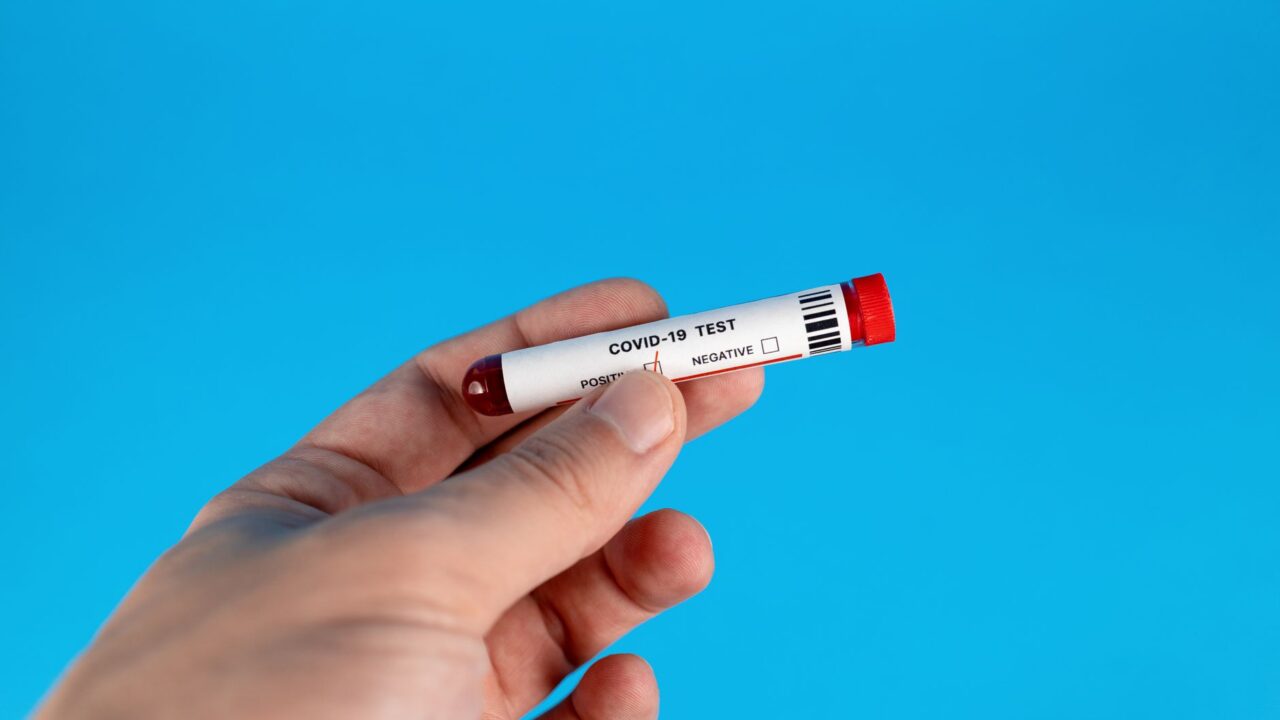 Function Health vs SiPhox Health: Finger-Prick or Full Draw Labs?