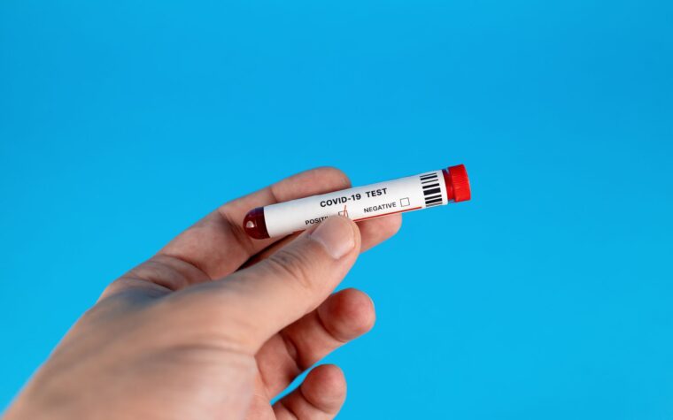 Function Health vs SiPhox Health: Finger-Prick or Full Draw Labs?