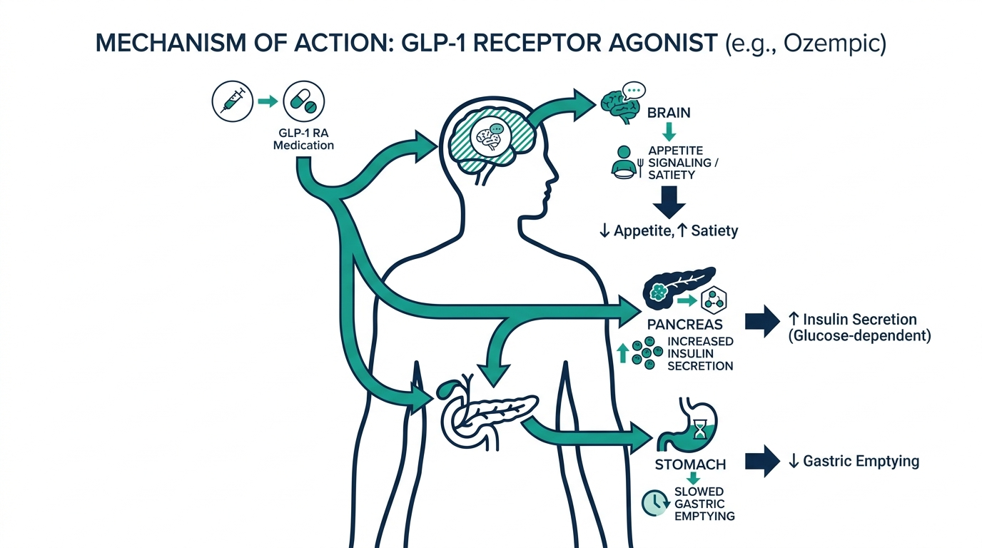 Diagram of a GLP-1 receptor agonist mechanism of action showing effects on the pancreas, brain, and stomach