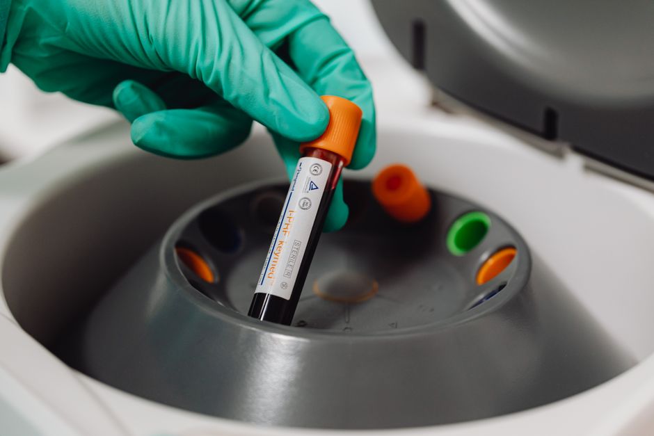 What Is NRBC in a Blood Test? The CBC Number That Should Read Zero - hematology analyzer