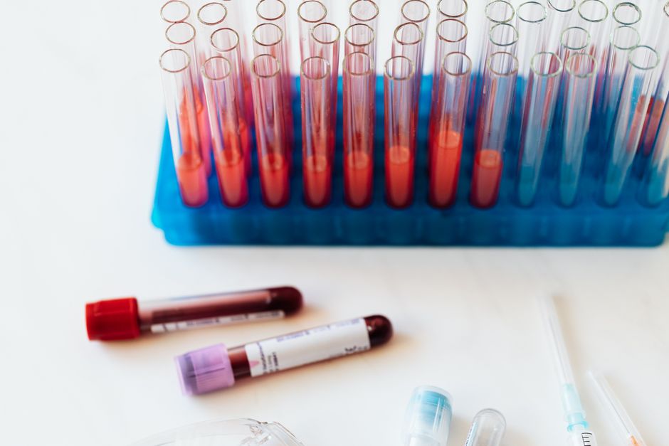 What Is a High MPV Blood Test? What an Elevated Result Really Means - hematology laboratory