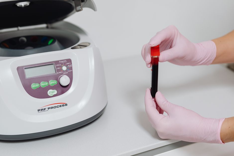Low MPV Blood Test: What a Low Mean Platelet Volume Really Means - hematology laboratory