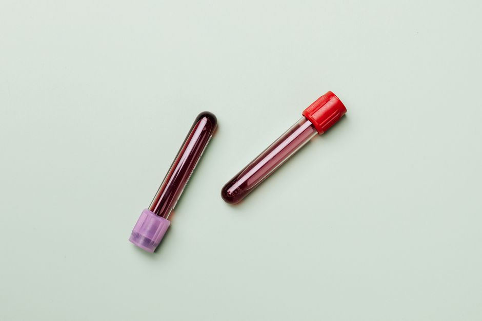 Function Health vs Ways2Well: Which Lab Service Wins in 2026? - home blood test collection