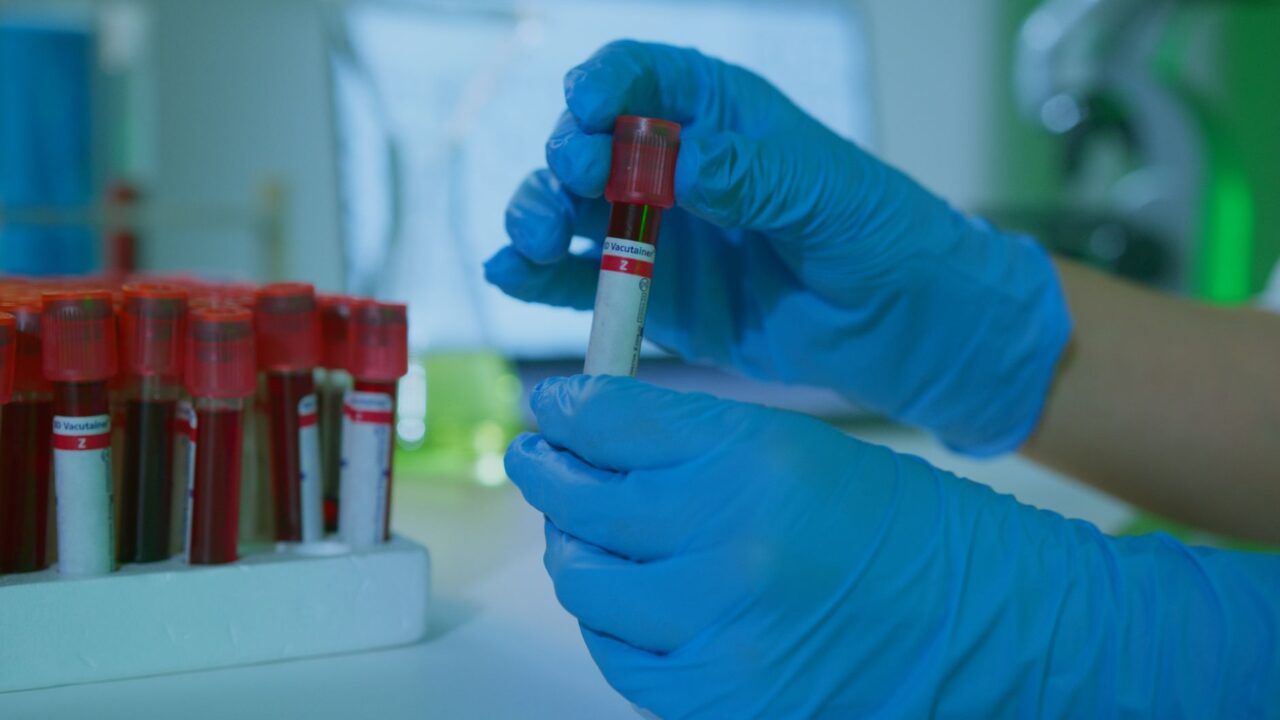 How to Order Your Own Lab Tests Online (No Doctor Visit)