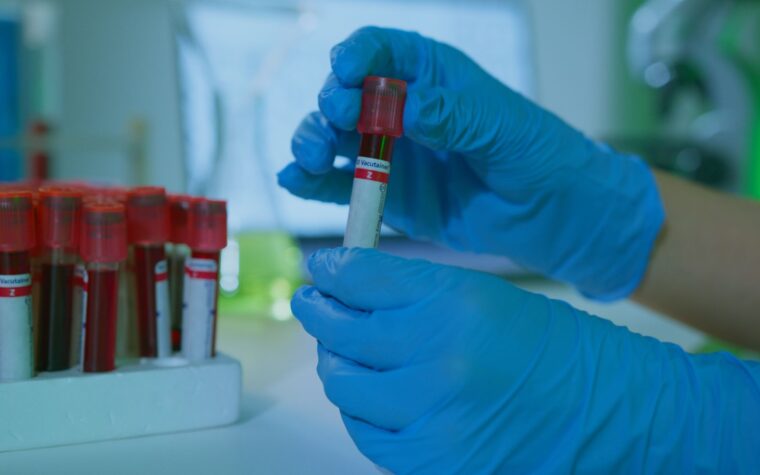 How to Order Your Own Lab Tests Online (No Doctor Visit)